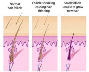 liposuction clinics kualalumpur Breast Enlargement | Hair Transplant | Tummy Tuck | Liposuction | SIx Pack Abs | Brazilian Buttock Lift | Divine Cosmetic Surgery - Corporate Office
