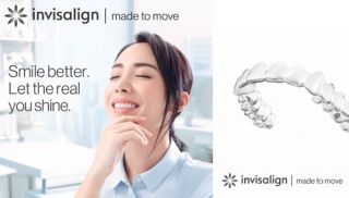 Invisalign (Aligner, Orthodontics)