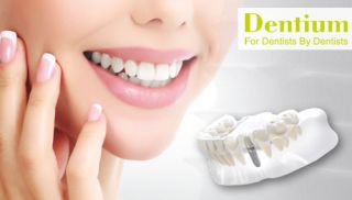 Dental Implant