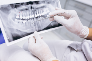 dental implantology courses kualalumpur Dental Implant KL Clinic